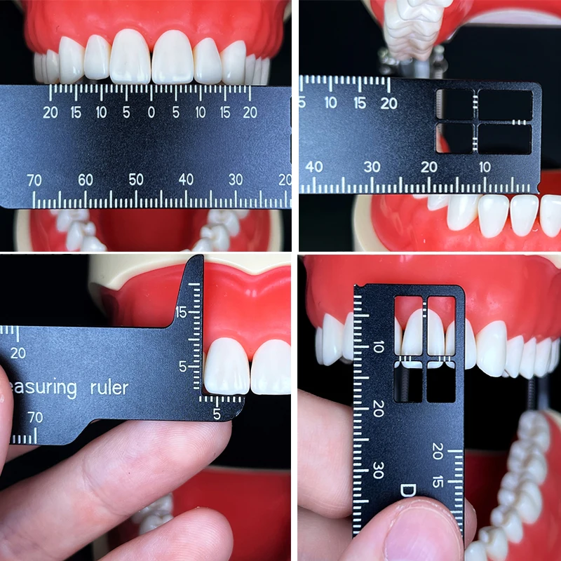 Photography Rules - Regla de medición de dientes de